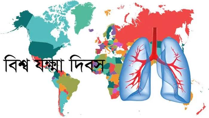 আজ বিশ্ব যক্ষ্মা দিবস : জানুন এই রোগের কারণ, লক্ষণ ও দিনটি পালনের গুরুত্ব।।।