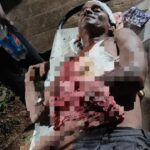 বাড়ি ফেরার পথেই হামলা বিজেপি নেতার উপর, চাঞ্চল্য পশ্চিম মেদিনীপুরের গড়বেতায়।