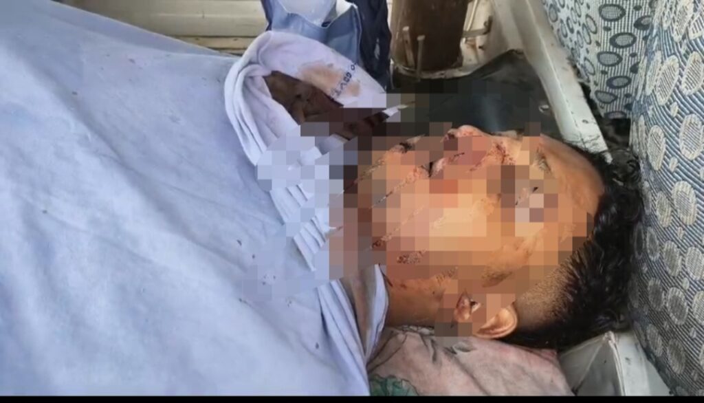 মোথাবাড়িতে তৃণমূল কর্মীর রক্তাক্ত দেহ উদ্ধার, রাজনৈতিক না ব্যক্তিগত শত্রুতা—তদন্তে পুলিশ।